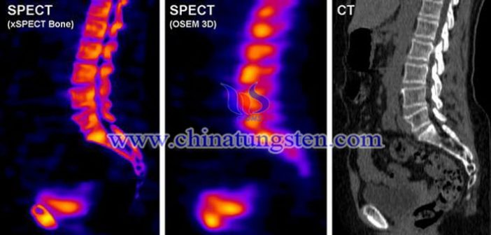 高比重鎢合金準直器用於SPECT系統(tǒng)圖片